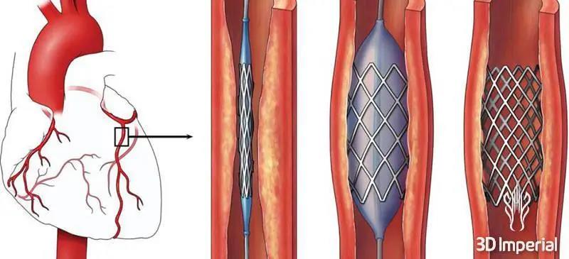 生物降解塑料最广泛TOP7大应用领域来了！(图28)